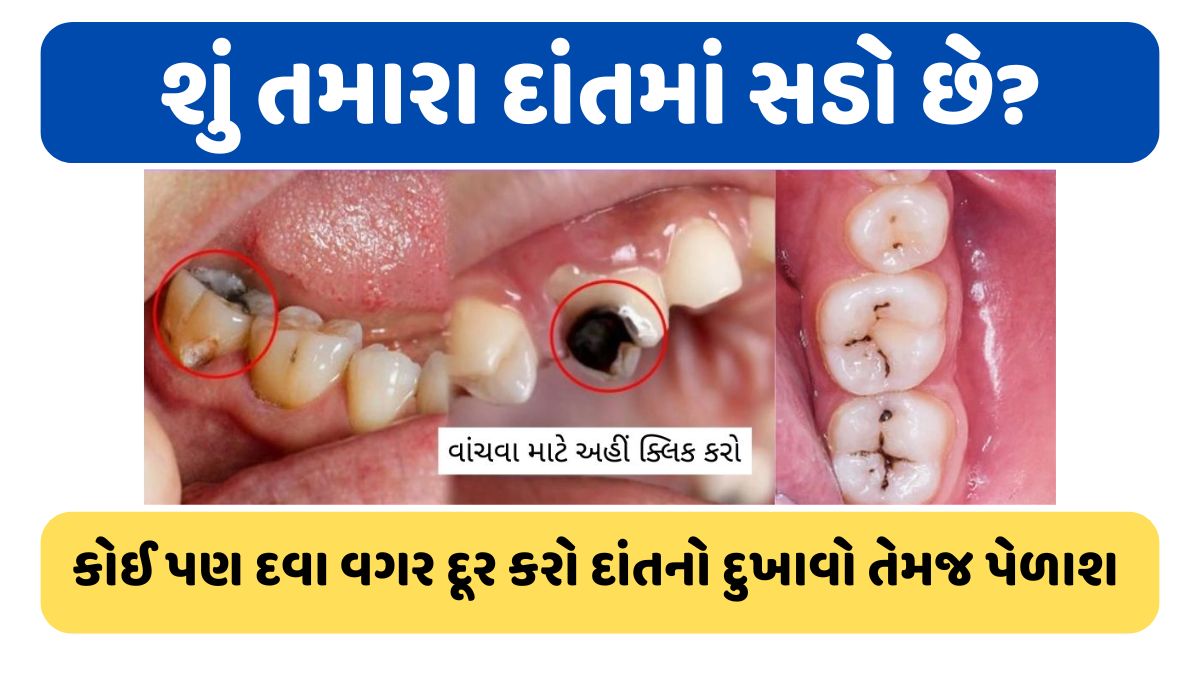 Ayurvedic Herbs Useful For Toothache